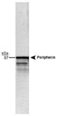 Western Blot: Peripherin Antibody [NB300-137]