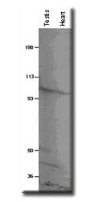 Western Blot: PDE8B Antibody [NB300-644]