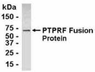 Western Blot: LAR/PTPRF Antibody [NB100-75290]