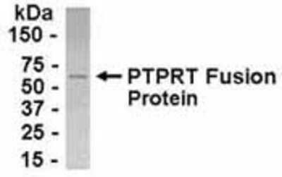 Western Blot: PTP rho/PTPRT Antibody [NB100-75300]