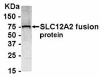 Western Blot: NKCC1/SLC12A2 AntibodyBSA Free [NB100-75623]