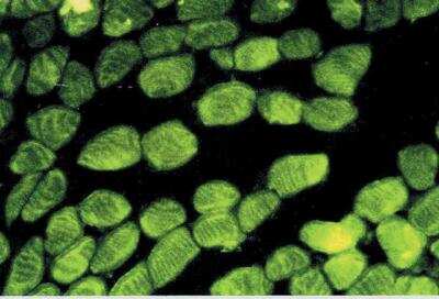Immunocytochemistry/ Immunofluorescence: pan Actin Antibody (AC-40) [NB120-11003]