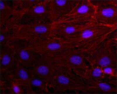 Immunocytochemistry/ Immunofluorescence: pan Actin Antibody (AC-40) [NB120-11003]