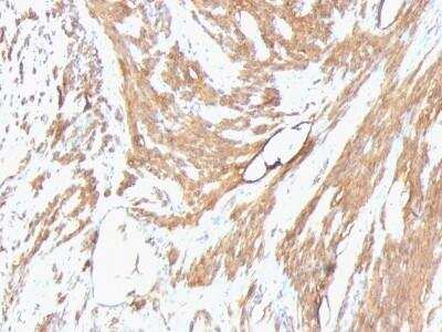 Immunohistochemistry-Paraffin: Actin (Muscle Specific) Antibody (HHF35 + MSA/953) - Azide and BSA Free [NBP2-47663]