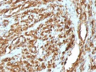 Immunohistochemistry-Paraffin: Actin (Muscle Specific) Antibody (HHF35 + MSA/953) - Azide and BSA Free [NBP2-47663]