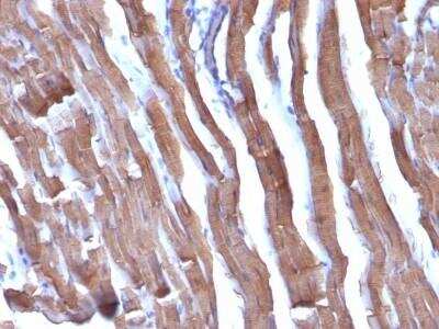 Immunohistochemistry-Paraffin: Actin (Muscle Specific) Antibody (HHF35 + MSA/953) - Azide and BSA Free [NBP2-47663]