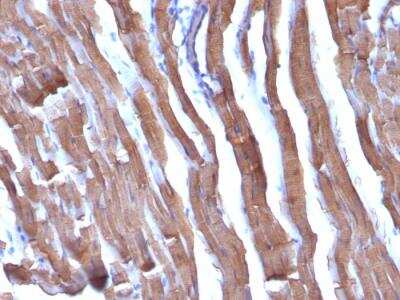 Immunohistochemistry-Paraffin: Actin (Muscle Specific) Antibody (HHF35 + MSA/953) - IHC-Prediluted [NBP2-48194]