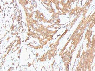 Immunohistochemistry-Paraffin: Actin (Muscle Specific) Antibody (HHF35 + MSA/953) - IHC-Prediluted [NBP2-48194]