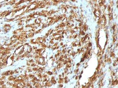 Immunohistochemistry-Paraffin: Actin (Muscle Specific) Antibody (HHF35 + MSA/953) - IHC-Prediluted [NBP2-48194]