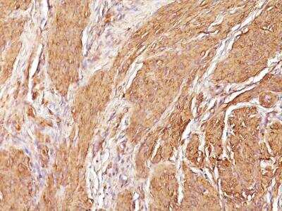 Immunohistochemistry-Paraffin: Actin (Muscle Specific) Antibody (SPM160) - IHC-Prediluted [NBP2-48188]