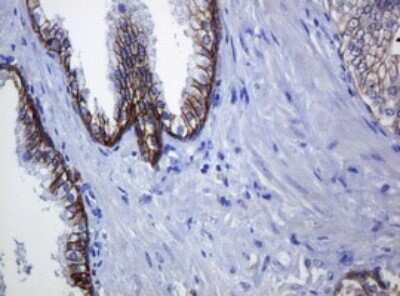 Immunohistochemistry: pan Cadherin Antibody (OTI4F1) [NBP2-46200]
