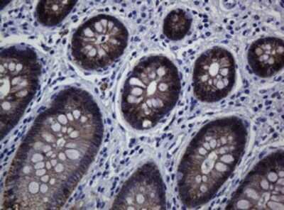 Immunohistochemistry: pan Cadherin Antibody (OTI4F1) [NBP2-46200]