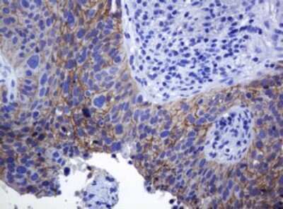 Immunohistochemistry: pan Cadherin Antibody (OTI4F1) [NBP2-46200]