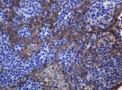 Immunohistochemistry: pan Cadherin Antibody (OTI4F1) [NBP2-46200]