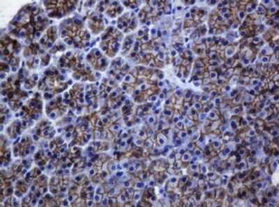 Immunohistochemistry: pan Cadherin Antibody (OTI4F1) [NBP2-46200]