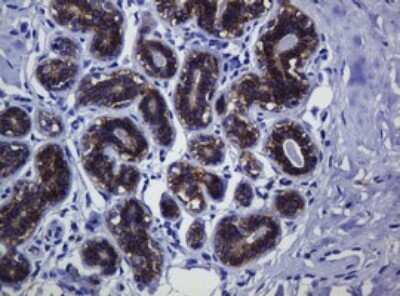 Immunohistochemistry: pan Cadherin Antibody (OTI4F1) [NBP2-46200]