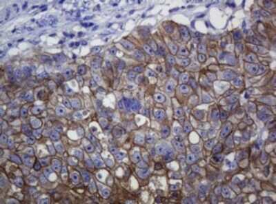 Immunohistochemistry: pan Cadherin Antibody (OTI4F1) [NBP2-46200]