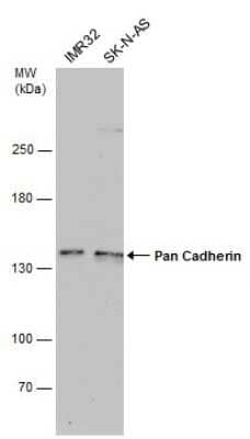 Western Blot: pan Cadherin Antibody (GT2610) [NBP3-13558]