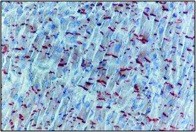 Immunohistochemistry: pan Cadherin Antibody [NB200-592]