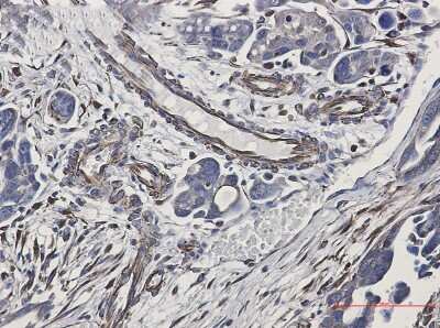 Immunohistochemistry-Paraffin: pan Cadherin Antibody (S04-5A8) [NBP3-15073]