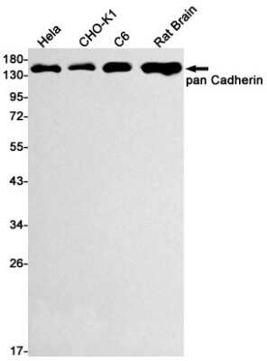 Western Blot: pan Cadherin Antibody (S04-5A8) [NBP3-15073]