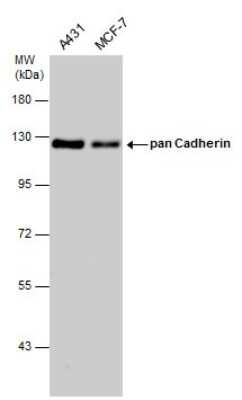 Western Blot: pan Cadherin Antibody [NBP3-13122]