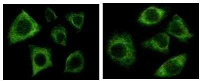 Immunocytochemistry/ Immunofluorescence: Cytokeratin, pan Antibody (7H8C4) - BSA Free [NBP1-51537]