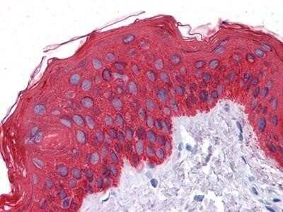 Immunohistochemistry-Paraffin: Cytokeratin, pan Antibody (7H8C4) - BSA Free [NBP1-51537]