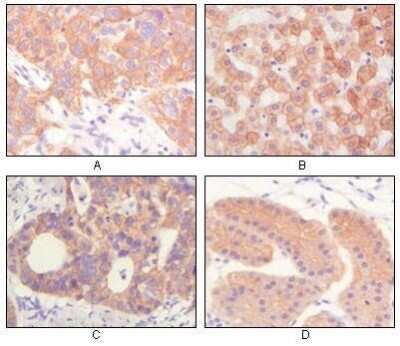 Immunohistochemistry-Paraffin: Cytokeratin, pan Antibody (7H8C4) - BSA Free [NBP1-51537]
