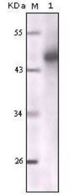 Western Blot: Cytokeratin, pan Antibody (7H8C4)BSA Free [NBP1-51537]