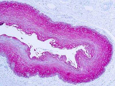 Immunohistochemistry-Paraffin: Cytokeratin, pan Antibody [NB600-579]