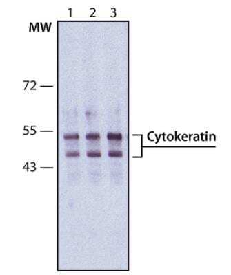 Western Blot: Cytokeratin, pan Antibody (PCK-26) [NB120-6401]