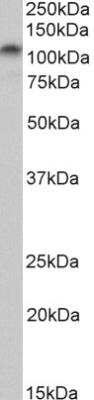 Western Blot: PSD-95 Antibody [NBP1-68836]