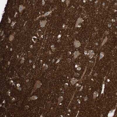 Immunohistochemistry: pan-Synuclein Antibody [NBP2-47338]