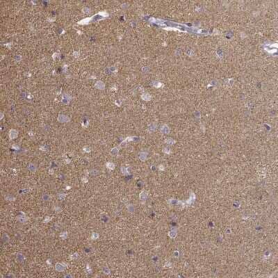 Immunohistochemistry-Paraffin: pan-Synuclein Antibody [NBP2-47338]