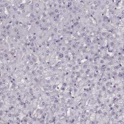 Immunohistochemistry-Paraffin: pan-Synuclein Antibody [NBP2-47338]