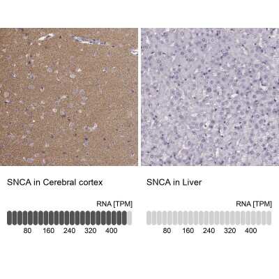 Immunohistochemistry-Paraffin: pan-Synuclein Antibody [NBP2-47338]