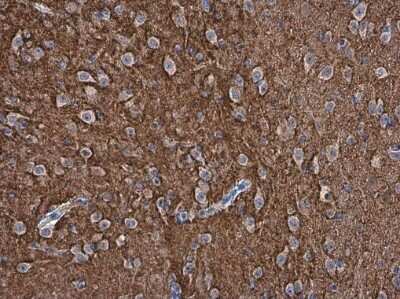 Immunohistochemistry-Paraffin: pan-Synuclein Antibody [NBP3-13218]