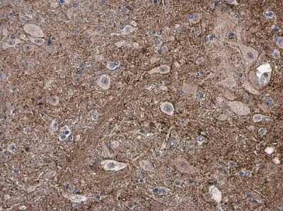 Immunohistochemistry-Paraffin: pan-Synuclein Antibody [NBP3-13218]