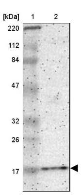 Western Blot: pan-Synuclein Antibody [NBP2-47338]