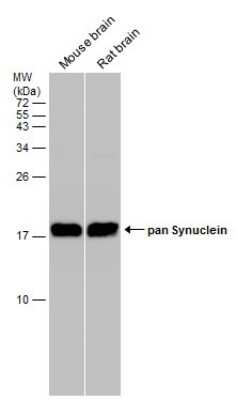 Western Blot: pan-Synuclein Antibody [NBP3-13218]