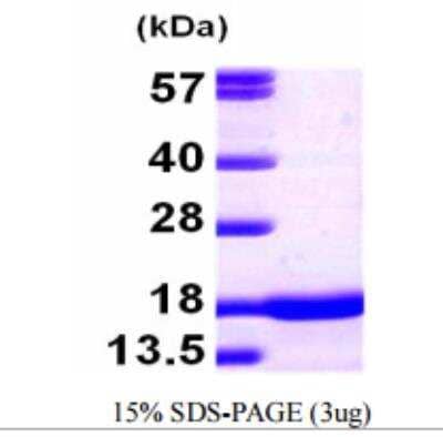 SDS-PAGE: Recombinant Mouse pan-Synuclein Protein [NBP1-72278]