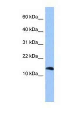 Western Blot: Parathyroid hormone 2 Antibody [NBP1-69679]