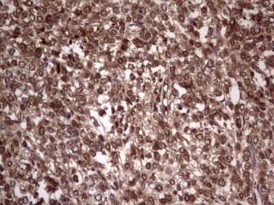Immunohistochemistry: phakinin Antibody (OTI4E7) [NBP2-46573]
