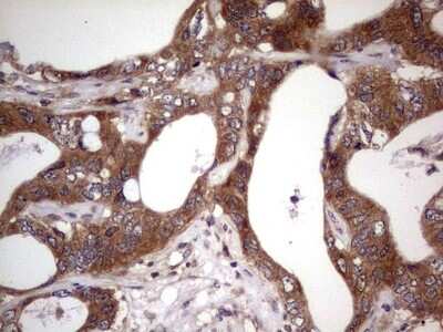 Immunohistochemistry: phakinin Antibody (OTI4E7) [NBP2-46573]