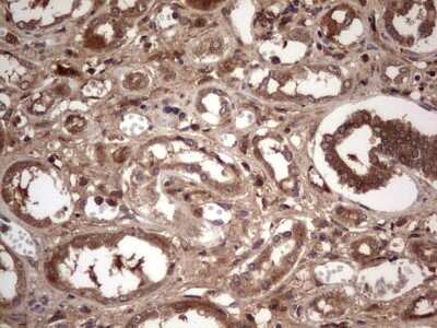 Immunohistochemistry: phakinin Antibody (OTI4E7) [NBP2-46573]