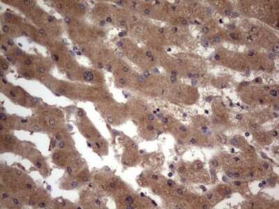Immunohistochemistry: phakinin Antibody (OTI4E7) [NBP2-46573]