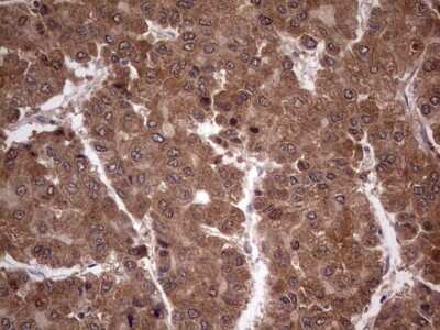 Immunohistochemistry: phakinin Antibody (OTI4E7) [NBP2-46573]