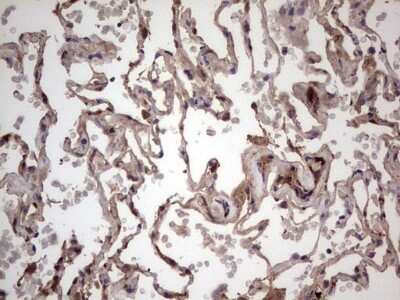 Immunohistochemistry: phakinin Antibody (OTI4E7) [NBP2-46573]