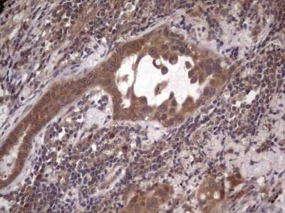 Immunohistochemistry: phakinin Antibody (OTI4E7) [NBP2-46573]